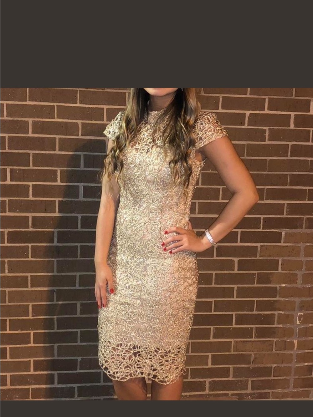 Gold Cap-Sleeve Lace Midi Dress